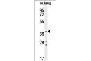 PTK9L Antibody (N-term) (ABIN655611 and ABIN2845093) western blot analysis in mouse lung tissue lysates (35 μg/lane). (TWF2 anticorps  (N-Term))