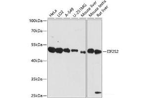 Western blot analysis of extracts of various cell lines using EIF2S2 Polyclonal Antibody at dilution of 1:3000. (EIF2S2 anticorps)