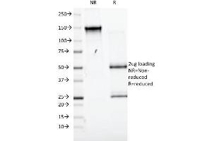 SDS-PAGE Analysis Purified CD98 Mouse Monoclonal Antibody (UM7F8). (SLC3A2 anticorps)