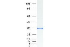 Validation with Western Blot