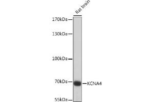 Western blot analysis of extracts of Rat brain, using KCN Rabbit pAb (ABIN7269486) at 1:1000 dilution.