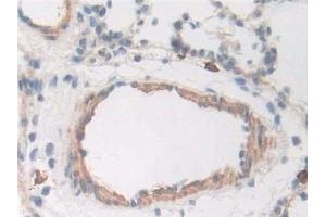 Detection of CD163 in Rat Trachea Tissue using Polyclonal Antibody to Cluster Of Differentiation (CD163)