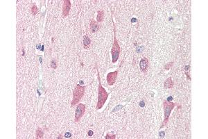 Anti-HPS6 antibody IHC staining of human brain, cortex. (HPS6 anticorps  (AA 455-466))
