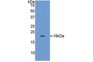 Detection of Recombinant SST, Mouse using Polyclonal Antibody to Somatostatin (SST)