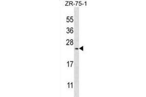 Western Blotting (WB) image for anti-BARX Homeobox 1 (BARX1) antibody (ABIN3003109) (BARX1 anticorps)