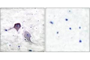 Immunohistochemistry analysis of paraffin-embedded human brain tissue, using Presenilin 1 Antibody.