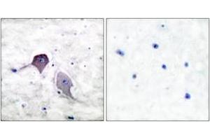 Immunohistochemistry analysis of paraffin-embedded human brain tissue, using Presenilin 1 Antibody. (Presenilin 1 anticorps  (AA 1-50))