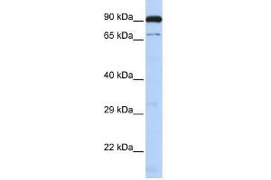 CTCFL antibody used at 1. (CTCFL anticorps  (N-Term))