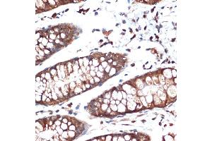 Immunohistochemistry of paraffin-embedded human colon using STK39 Rabbit mAb (ABIN1682890, ABIN3015922, ABIN3015923 and ABIN7101461) at dilution of 1:100 (40x lens).