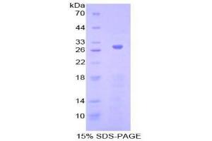 SDS-PAGE (SDS) image for Adenylate Cyclase 5 (ADCY5) (AA 167-385) protein (His tag) (ABIN1879467)