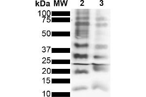 Western Blot analysis of Purified poly-ubiquitin chains showing detection of Multiple Ubiquitin protein using Rabbit Anti-Ubiquitin Monoclonal Antibody, Clone FK2 (ABIN5695851). (Ubiquitin anticorps  (FITC))