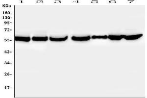 Western blot analysis of PTBP2 using anti-PTBP2 antibody (ABIN7599452). (PTBP2 anticorps  (AA 1-504))