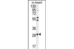 RN Antibody (Center) (ABIN654316 and ABIN2844098) western blot analysis in mouse heart tissue lysates (35 μg/lane). (RNF183 anticorps  (AA 86-114))