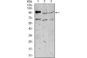 Western blot analysis using NEFM mouse mAb against NTERA-2 (1), SK-N-SH (2), and PC-12 (3) cell lysate.