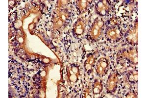 Immunohistochemistry of paraffin-embedded human small intestine tissue using ABIN7143509 at dilution of 1:100 (ARL4D anticorps  (AA 2-201))