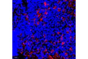 Immunofluorescence of paraffin embedded rat spleen using ANXA3 (ABIN7073065) at dilution of 1: 300 (400x lens)