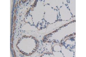 IHC-P analysis of lung tissue, with DAB staining.