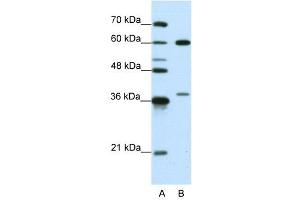 HNRPL antibody used at 0. (HNRNPL anticorps  (N-Term))