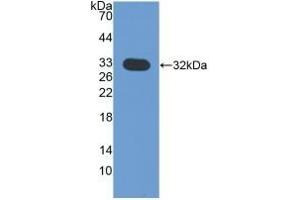 Detection of Recombinant CHIT1, Mouse using Polyclonal Antibody to Chitinase 1 (CHIT1) (Chitotriosidase 1 anticorps  (AA 210-464))