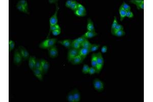 Immunofluorescence staining of HepG2 cells with ABIN7158788 at 1:100, counter-stained with DAPI. (LAPTM4A anticorps  (AA 181-233))