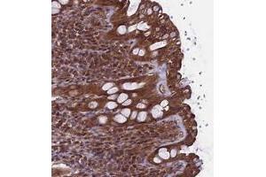 Immunohistochemical staining of human rectum with TTLL10 polyclonal antibody  shows moderate cytoplasmic positivity in glandular cells at 1:50-1:200 dilution. (TTLL10 anticorps)