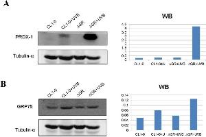 Representative immunoblot validation of (A) Peroxiredoxin-1 (B) GRP75 levels in CL1-0 cells and CL1-0ΔGR cells in response to UVB-irradiation. (Peroxiredoxin 1 anticorps)