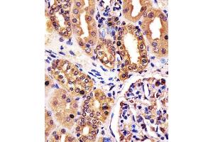 (ABIN6242612 and ABIN6578254) staining RNF7 in human kidney tissue sections by Immunohistochemistry (IHC-P - paraformaldehyde-fixed, paraffin-embedded sections). (RNF7 anticorps  (N-Term))