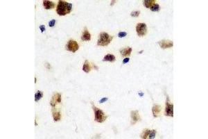 Immunohistochemical analysis of FMR1 staining in rat brain formalin fixed paraffin embedded tissue section.