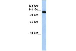 MYBPC2 antibody used at 1 ug/ml to detect target protein.