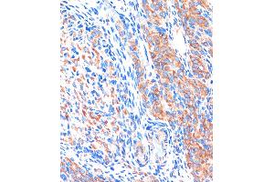 Immunohistochemistry of paraffin-embedded Rat ovary using ME3 Rabbit pAb (ABIN7268384) at dilution of 1:100 (40x lens). (ME3 anticorps  (AA 505-604))
