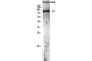 Western Blot (WB) analysis of Mouse Lung lysis using C7 antibody. (C7 anticorps)
