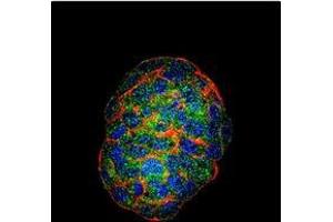 Confocal immunofluorescent analysis of GBE1 Antibody (Center) Cat.