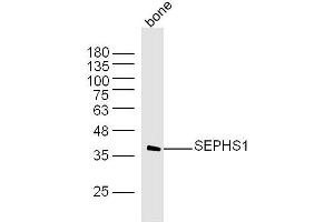 Mouse bone lysates probed with SEPHS1 Polyclonal Antibody, Unconjugated  at 1:300 dilution and 4˚C overnight incubation.