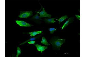 Immunofluorescence of purified MaxPab antibody to S100A10 on HeLa cell.