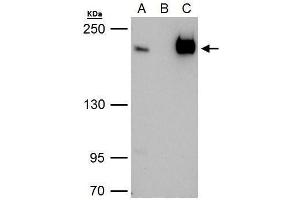 IP Image TAF172 antibody immunoprecipitates TAF172 protein in IP experiments.