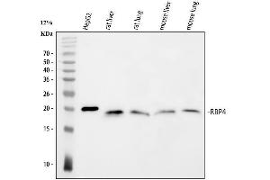 Western blot analysis of RBP4 using anti-RBP4 antibody (ABIN5519056). (RBP4 anticorps  (AA 19-201))