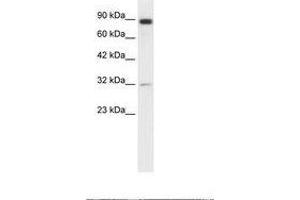 Image no. 1 for anti-Matrix Metallopeptidase 9 (Gelatinase B, 92kDa Gelatinase, 92kDa Type IV Collagenase) (MMP9) (AA 172-221) antibody (ABIN203273)