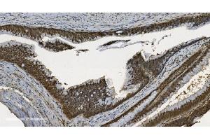 IHC analysis of U2AF65/U2AF2 using anti U2AF65/U2AF2 antibody (ABIN7600794). (U2AF2 anticorps  (AA 238-470))