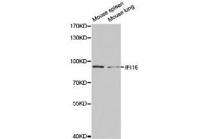 Western blot analysis of extracts of various cell lines, using IFI16 antibody. (IFI16 anticorps  (AA 1-300))