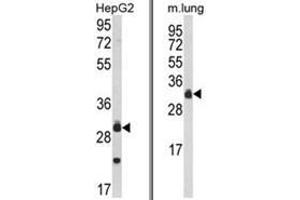 (LEFT) Western blot analysis of MyD88 Antibody (Center) in HepG2 cell line lysates (35ug/lane). (MYD88 anticorps  (Middle Region))