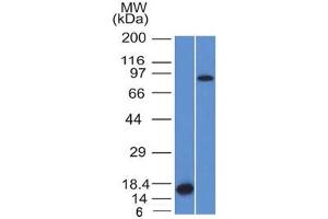 Western blot testing of 1) partial human recombinant protein and 2) human HeLa lysate with Factor XIIIa antibody (clone F13A1/1448). (F13A1 anticorps  (AA 46-181))