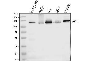 Western blot analysis of Neuropilin 1 using anti-Neuropilin 1 antibody (ABIN7601921).