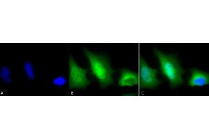Immunocytochemistry/Immunofluorescence analysis using Rabbit Anti-SOD (Cu/Zn) Polyclonal Antibody (ABIN361651 and ABIN361652). (SOD1 anticorps)