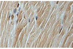 Immunohistochemical staining of formalin-fixed paraffin-embedded human fetal skeletal muscle showing staining with AP3D1 polyclonal antibody  at 1:100 dilution. (AP3D1 anticorps)