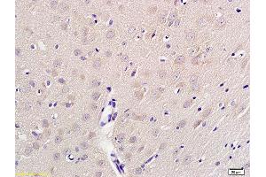 Formalin-fixed and paraffin embedded rat brain tissue labeled with Anti-phospho-ADRB2(Ser346) Polyclonal Antibody, Unconjugated (ABIN682723) at 1:200 followed by conjugation to the secondary antibody and DAB staining