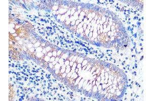 Immunohistochemistry of paraffin-embedded human appendix using V Rabbit mAb (ABIN7271317) at dilution of 1:100 (40x lens). (VAMP8 anticorps)