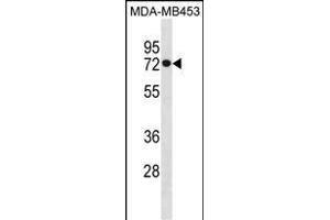 HSL Antibody (C-term) (ABIN1881439 and ABIN2850525) western blot analysis in MDA-M cell line lysates (35 μg/lane). (HSPA1L anticorps  (C-Term))
