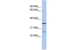 WB Suggested Anti-SDR-O Antibody Titration: 0. (SDR9C7 anticorps  (Middle Region))