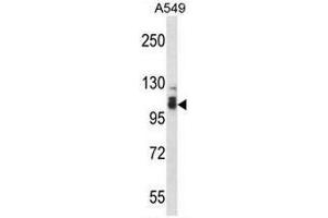 SMEK2 Antibody (C-term) western blot analysis in A549 cell line lysates (35µg/lane). (SMEK2 anticorps  (C-Term))