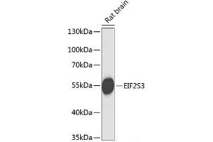 Western blot analysis of extracts of Rat brain using EIF2S3 Polyclonal Antibody at dilution of 1:1000. (EIF2S3 anticorps)